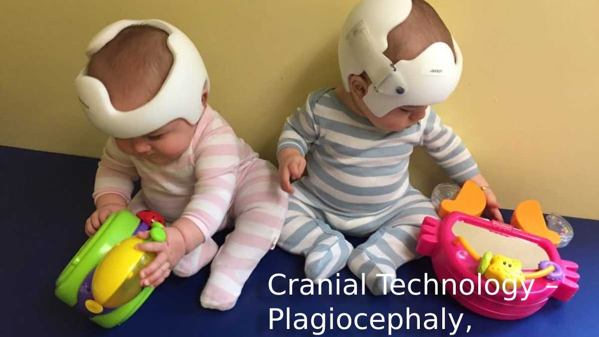 Cranial Technology – Plagiocephaly, Symptoms, and More