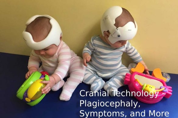 Cranial Technology